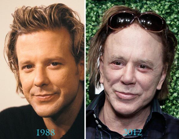 Mickey Rourke